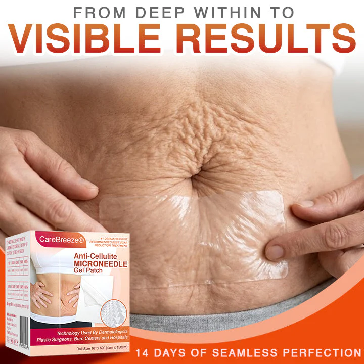 CareBreeze® Anti-Cellulite Microneedle Patch - Image 6