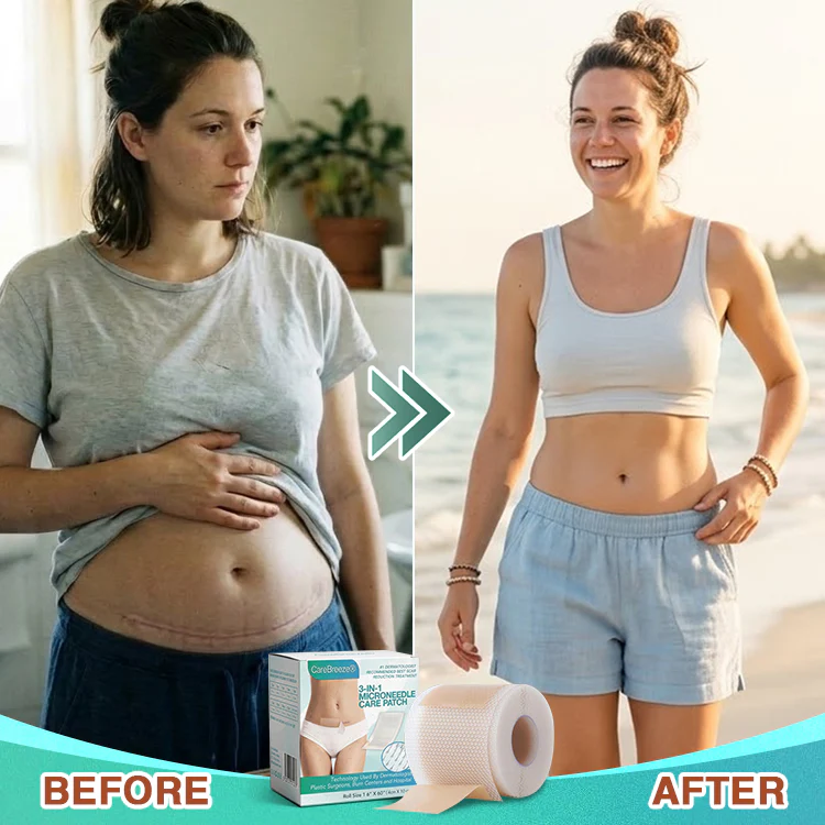 𝗖𝗮𝗿𝗲𝗕𝗿𝗲𝗲𝘇𝗲® 3-in-1 Microneedle Care Patch - Image 4