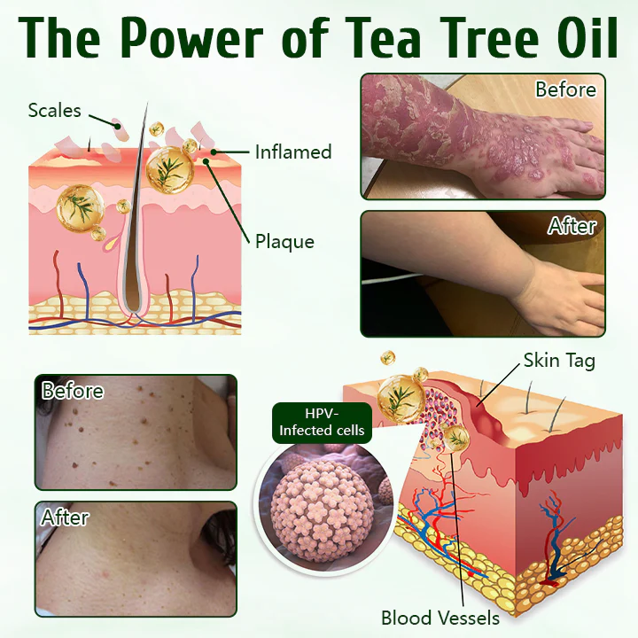 ✅ Timilk® Tea Tree Skin Healing Cream - Image 2
