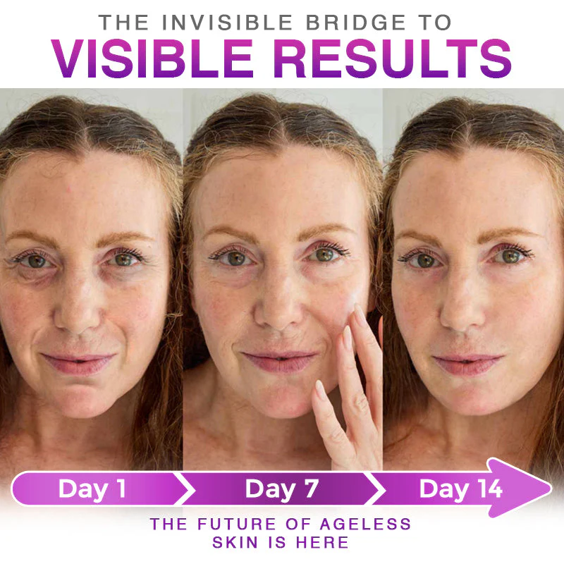 CareBreeze® 3-in-1 Microneedle Anti-Aging Patch - Image 7