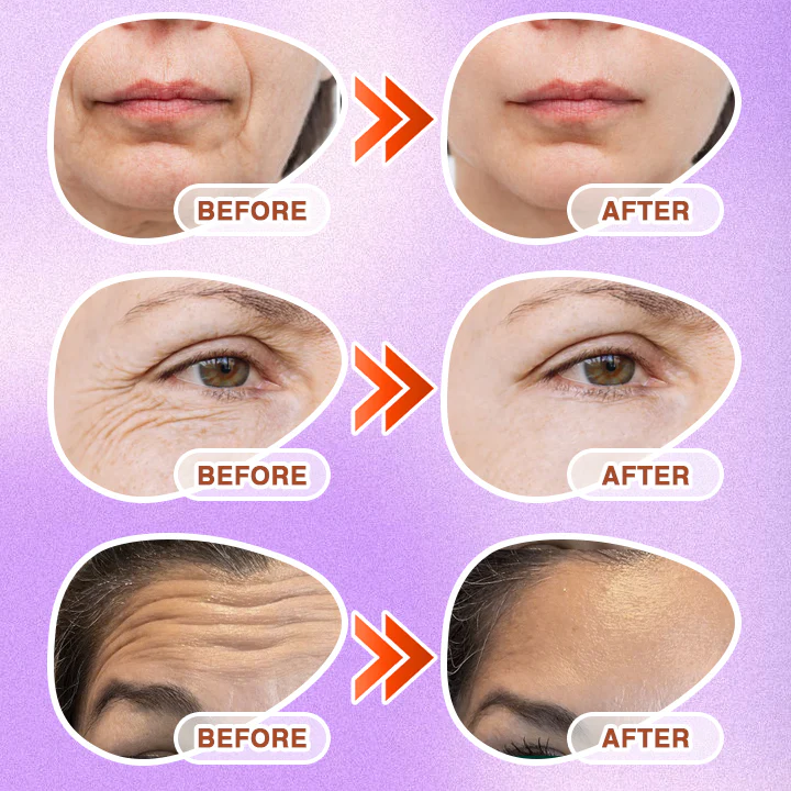 CareBreeze® 3-in-1 Microneedle Anti-Aging Patch - Image 4