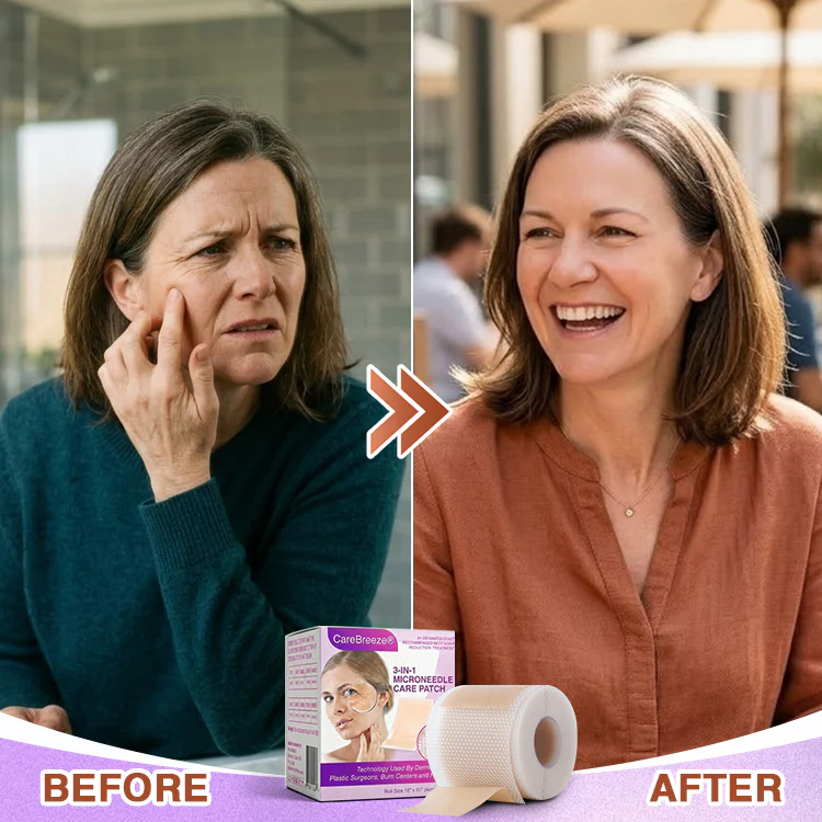𝘾𝙖𝙧𝙚𝘽𝙧𝙚𝙚𝙯𝙚® Microneedle Anti-Aging Care Patch - Image 11