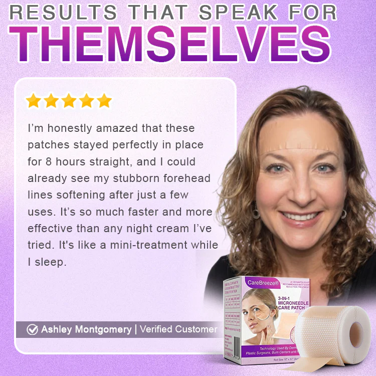 𝘾𝙖𝙧𝙚𝘽𝙧𝙚𝙚𝙯𝙚® Microneedle Anti-Aging Care Patch - Image 9