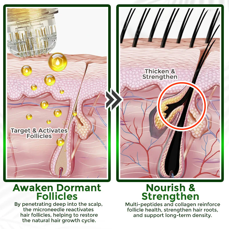 flysmus® Microneedle Herbal Infusion Hair Stimulation Set 🇺🇸 - Image 3