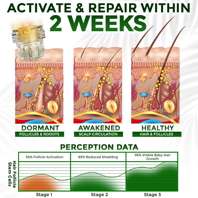 flysmus® Microneedle Herbal Infusion Hair Stimulation Set 🇺🇸 - Image 4