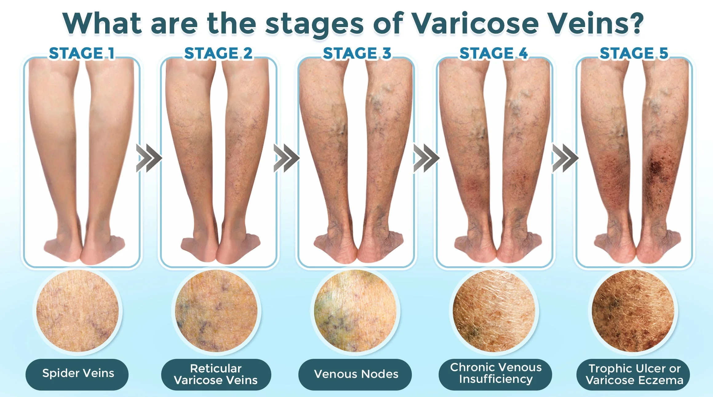 VenaRestore MicroNeedle Vein Repair Patch 🇺🇸 - Image 4